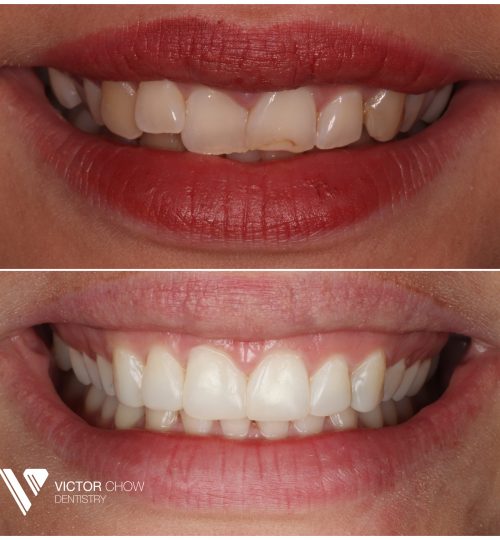 Dr Victor Chow Invisalign